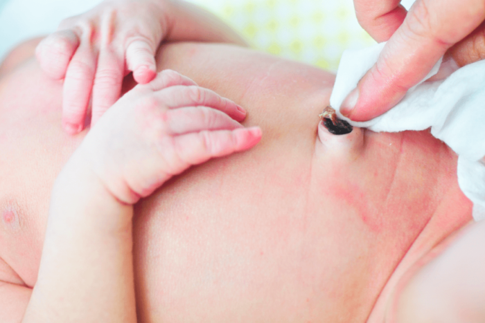 Descubra Como Cuidar De Um Umbigo De Bebe Inflamado Em 5 Passos Simples